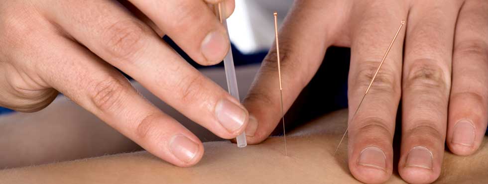 Two hands dry needling a person's legs